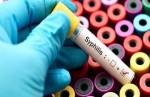 Alerta: Lafaiete vive epidemia de sífilis