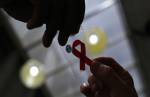 Brasil reduz em 8% casos de infecção por tuberculose e HIV