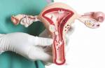 JORNAL FOB: Cuidados ginecológicos e saúde feminina