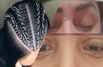 Alerta: Pomada modeladora de cabelo pode causar cegueira temporária