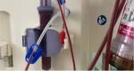 Sindijori: Hospital de Pouso Alegre amplia hemodiálise