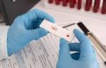 Anvisa autoriza realização de exame de análise clínica em farmácias
