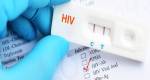 Metade dos diagnósticos de HIV em Minas atinge jovens entre 20 e 34 anos
