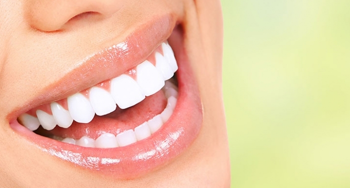 Mitos e verdades sobre clareamento dental que você precisa saber