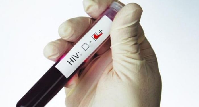 Vacina contra HIV será testada ainda este ano
