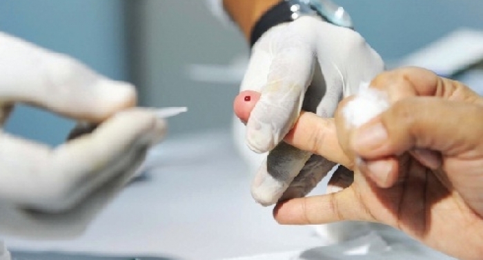 Silenciosas, hepatites B e C matam mais que o vírus da Aids