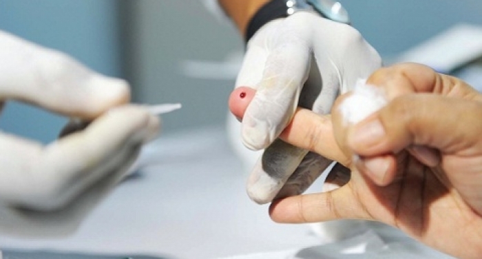 Silenciosas, hepatites B e C matam mais que o vírus da Aids